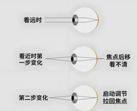 多参加户外活动远离近视(图3) 多参加户外活动远离近视(图3)