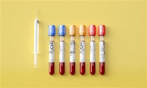 2024共享单车行业市场深度调研及未来发展空间预测(图6)